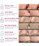SHAMFY BLACKHEAD REMOVER